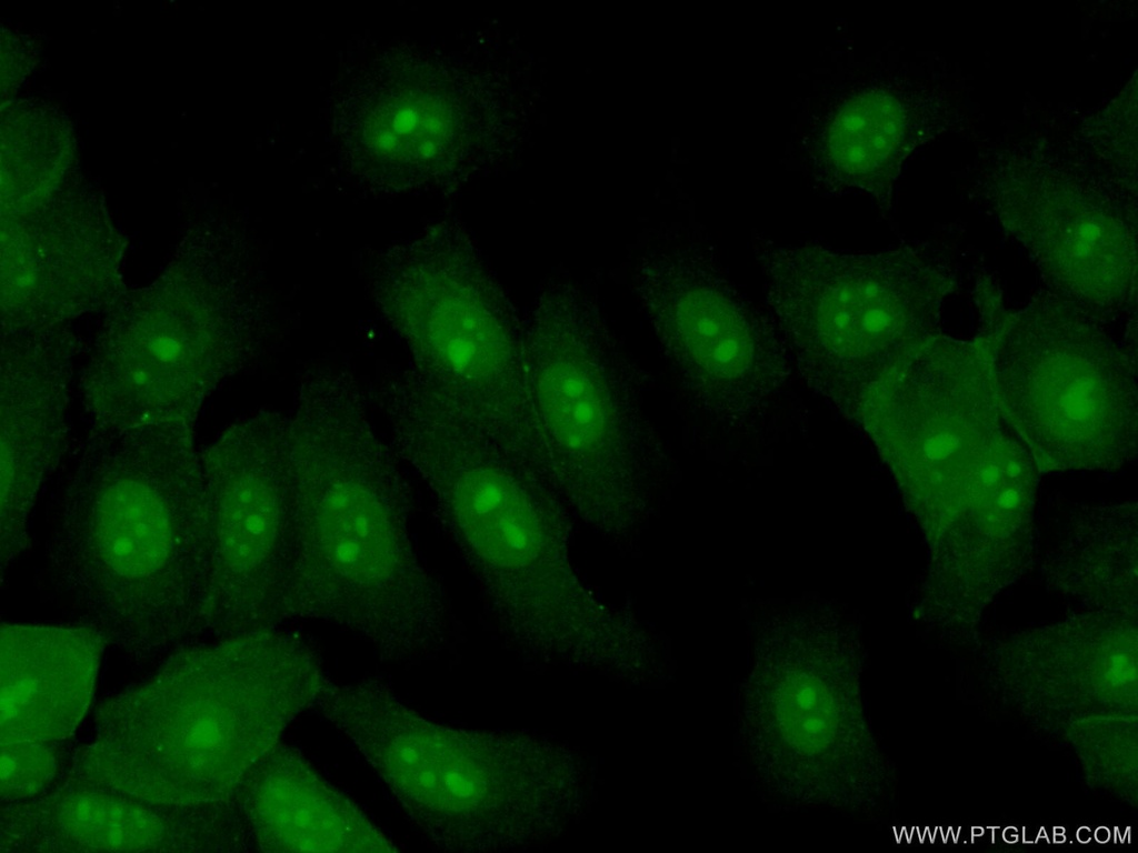 EXOSC7 Polyclonal antibody
