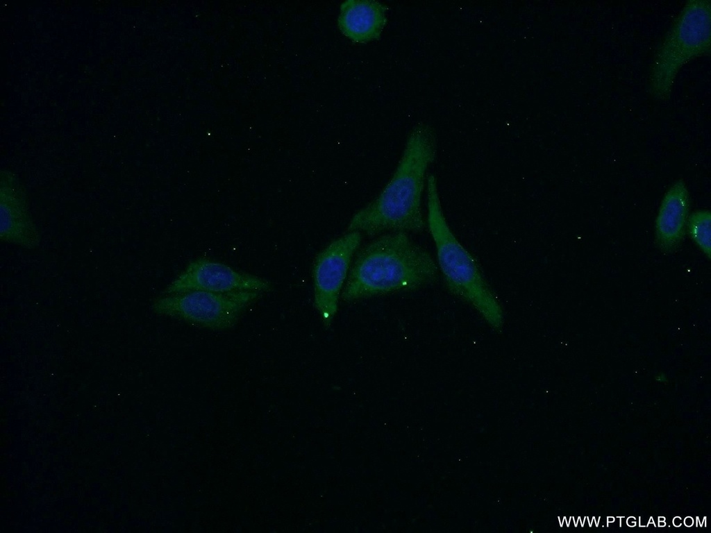 ZNF460 Polyclonal antibody