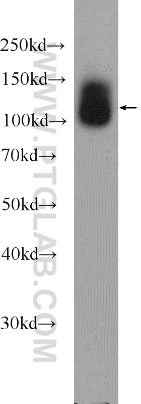 TMEM132A Polyclonal antibody