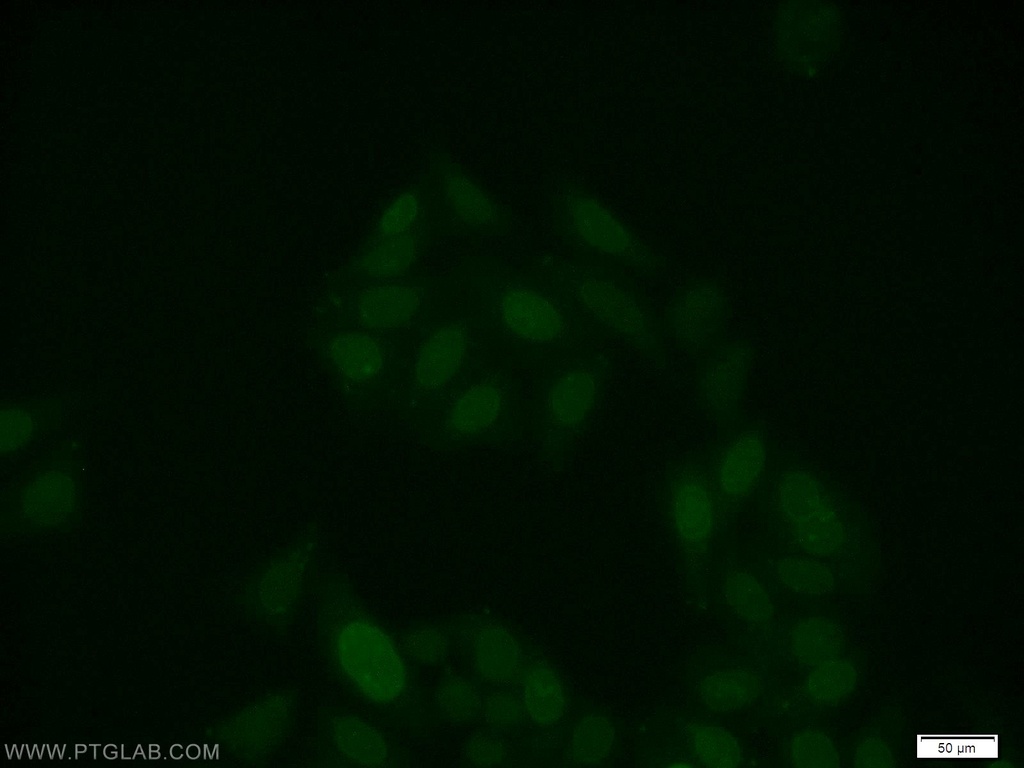 RUNX1 (middle) Polyclonal antibody