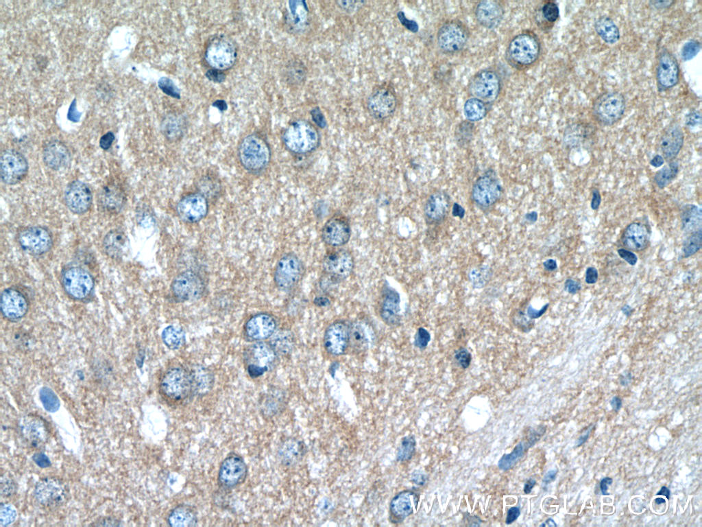 ATP6V1G2 Polyclonal antibody