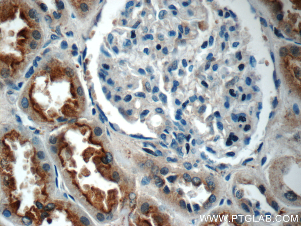 IQSEC2 Polyclonal antibody