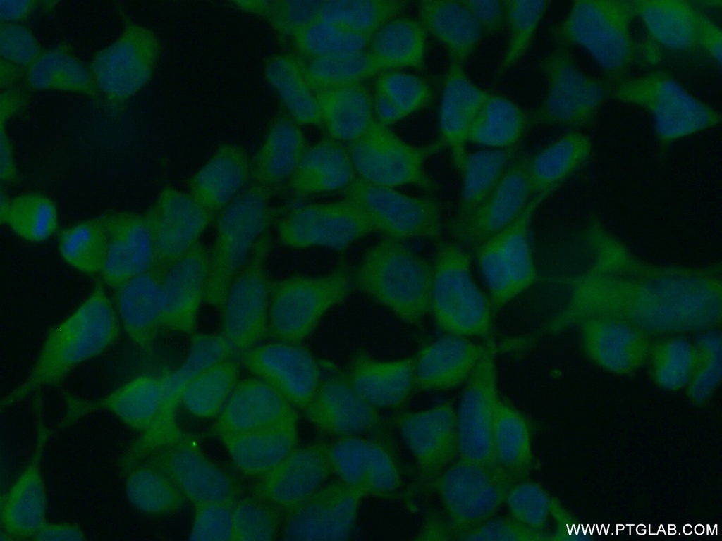 CHD3 Polyclonal antibody