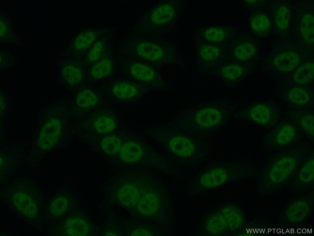 RTEL1 Polyclonal antibody