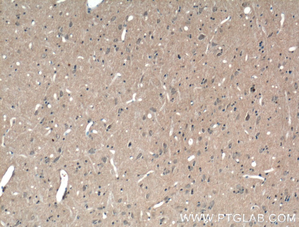 ABCA7 Polyclonal antibody