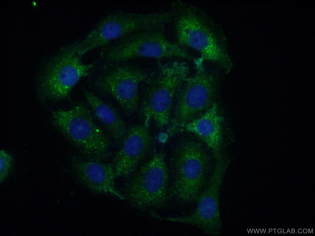 CPEB4 Polyclonal antibody