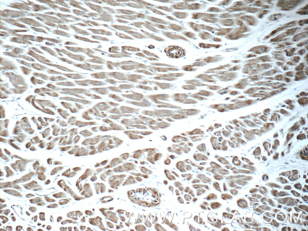 AGTR1 Polyclonal antibody