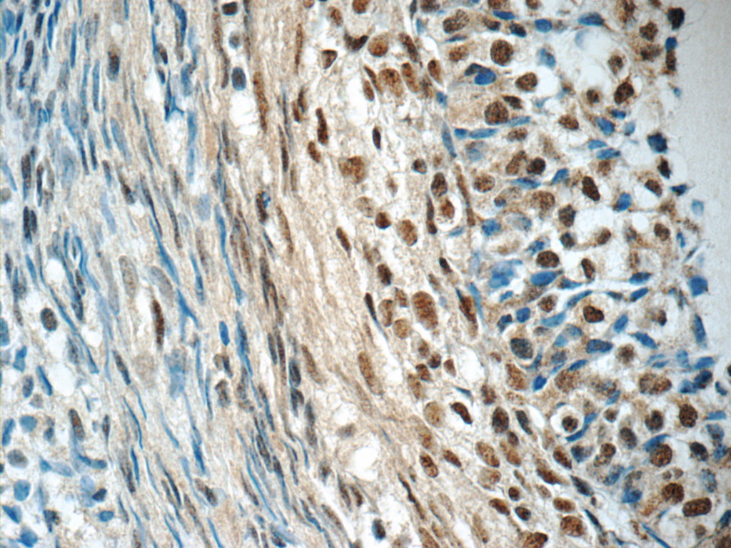 SENP1 Polyclonal antibody