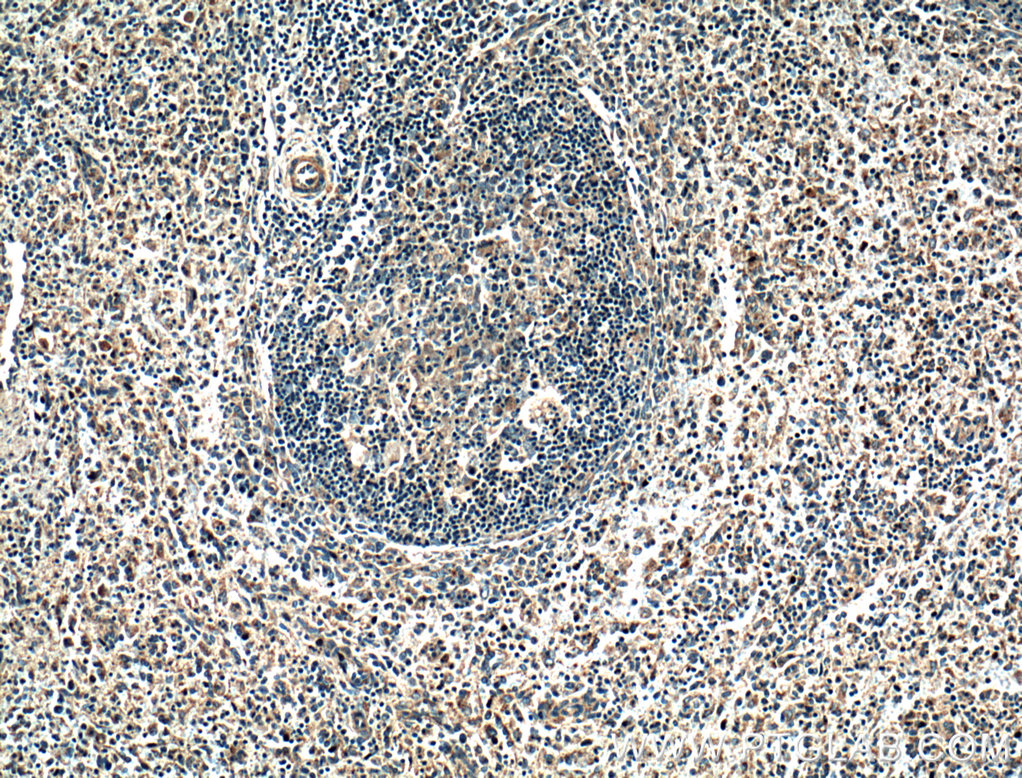 NOX5 Polyclonal antibody