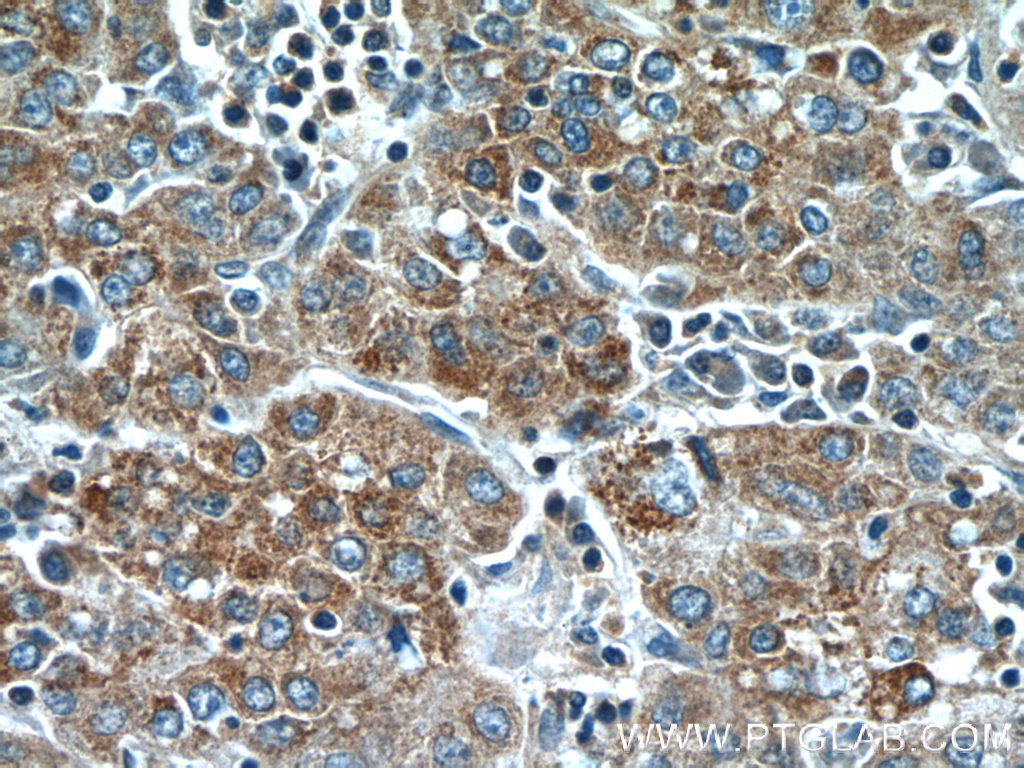 TMEM182 Polyclonal antibody