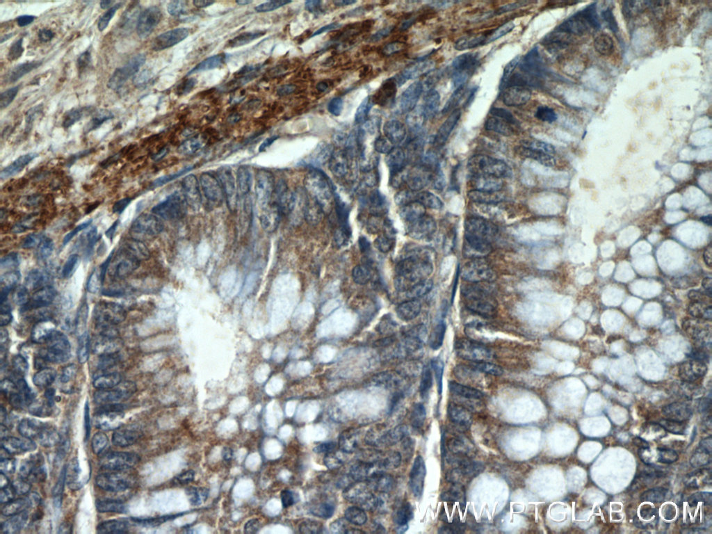 HIGD1B Polyclonal antibody