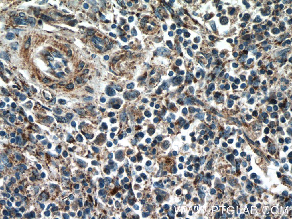 YOD1 Polyclonal antibody