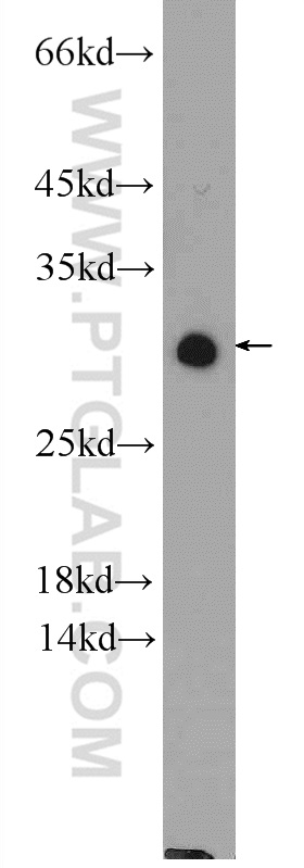 NUP62CL Polyclonal antibody