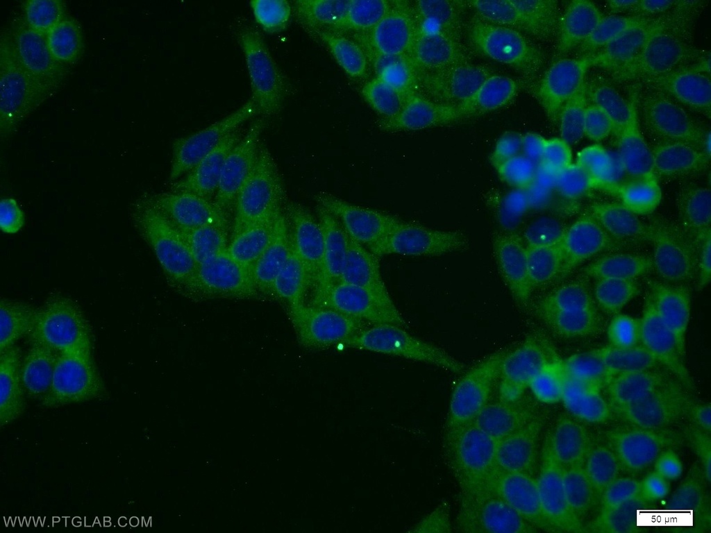 CYTSA Polyclonal antibody