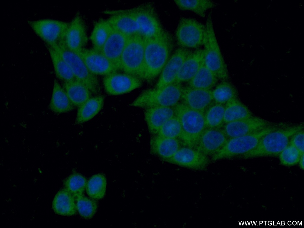 G6PD Polyclonal antibody