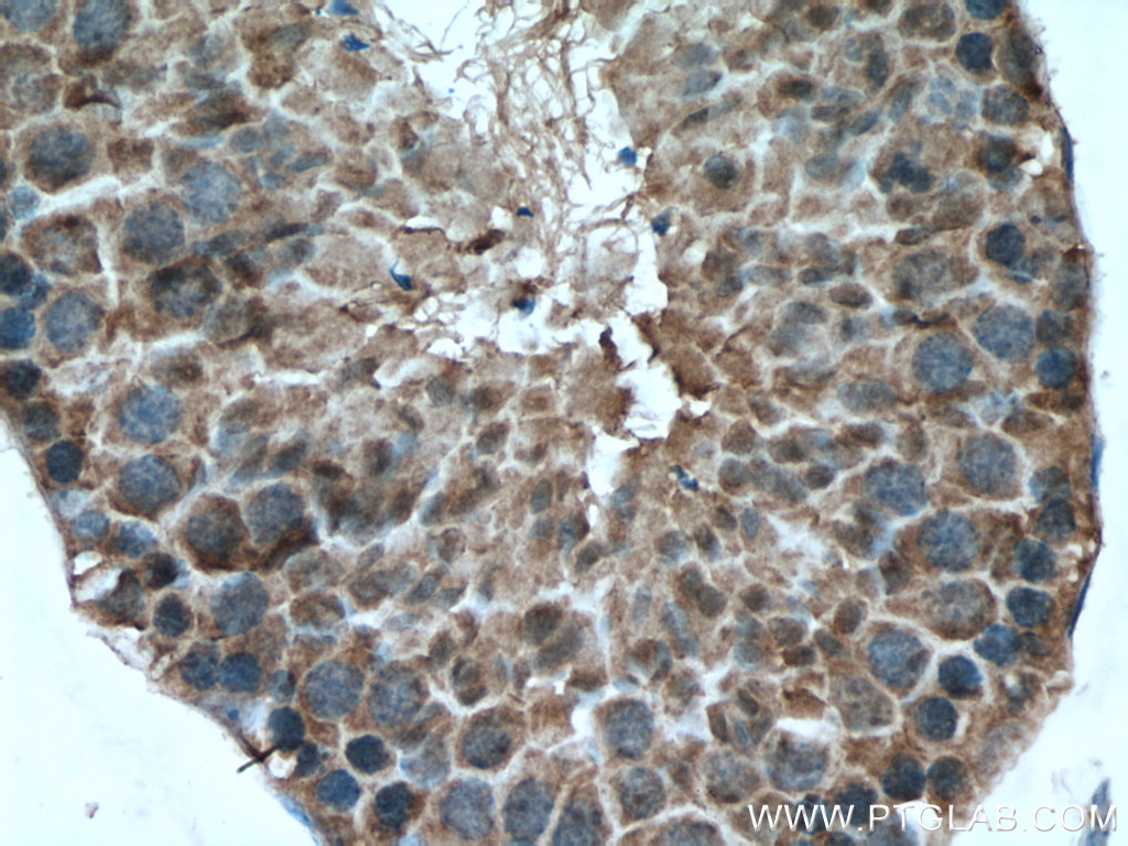 SRPK2 Polyclonal antibody