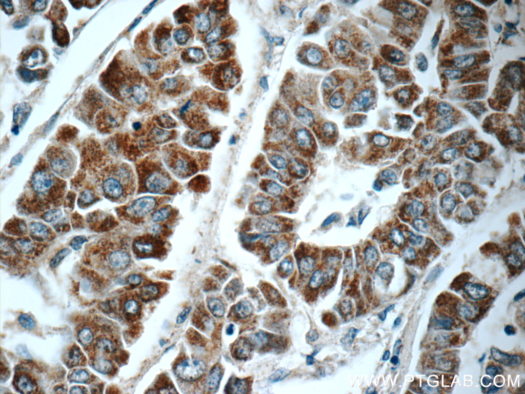 C1orf56 Polyclonal antibody