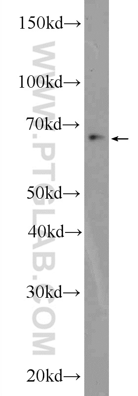 ZBTB46 Polyclonal antibody