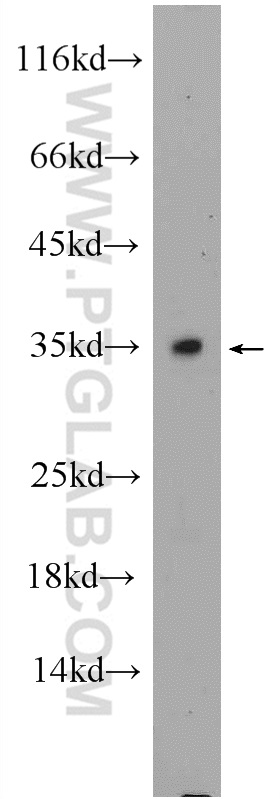 C2orf51 Polyclonal antibody