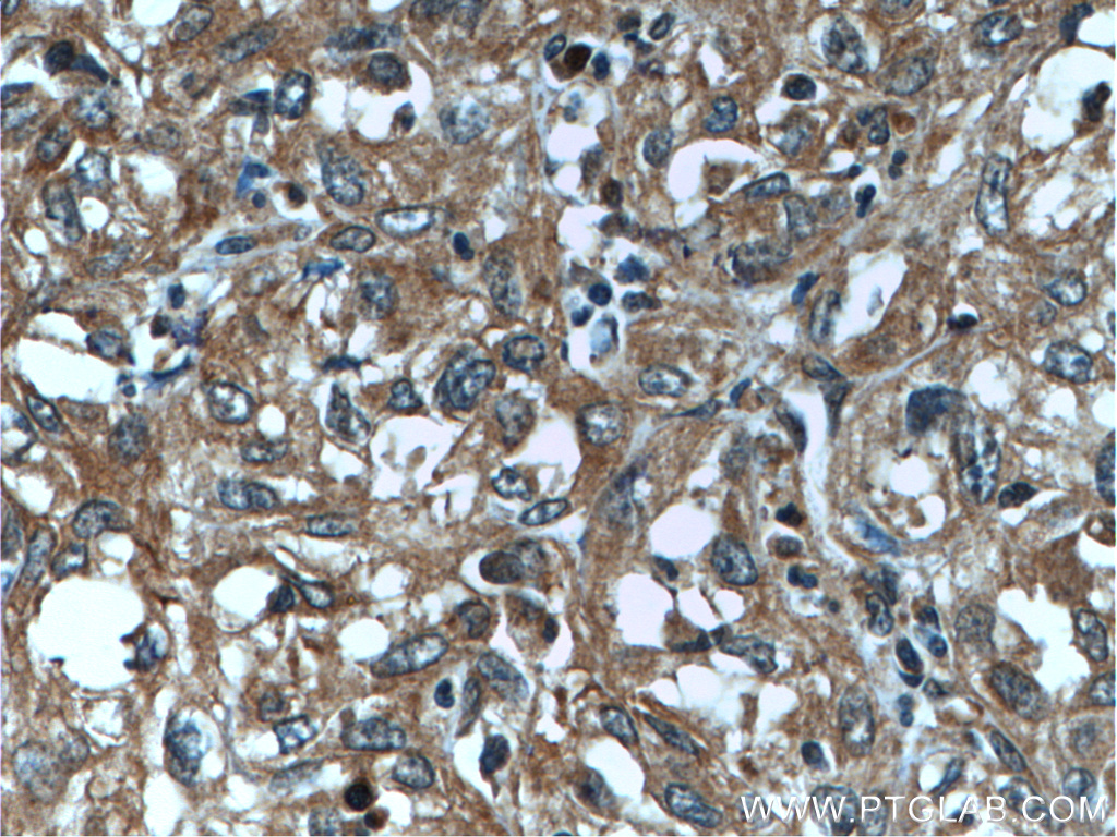 PNPLA4 Polyclonal antibody