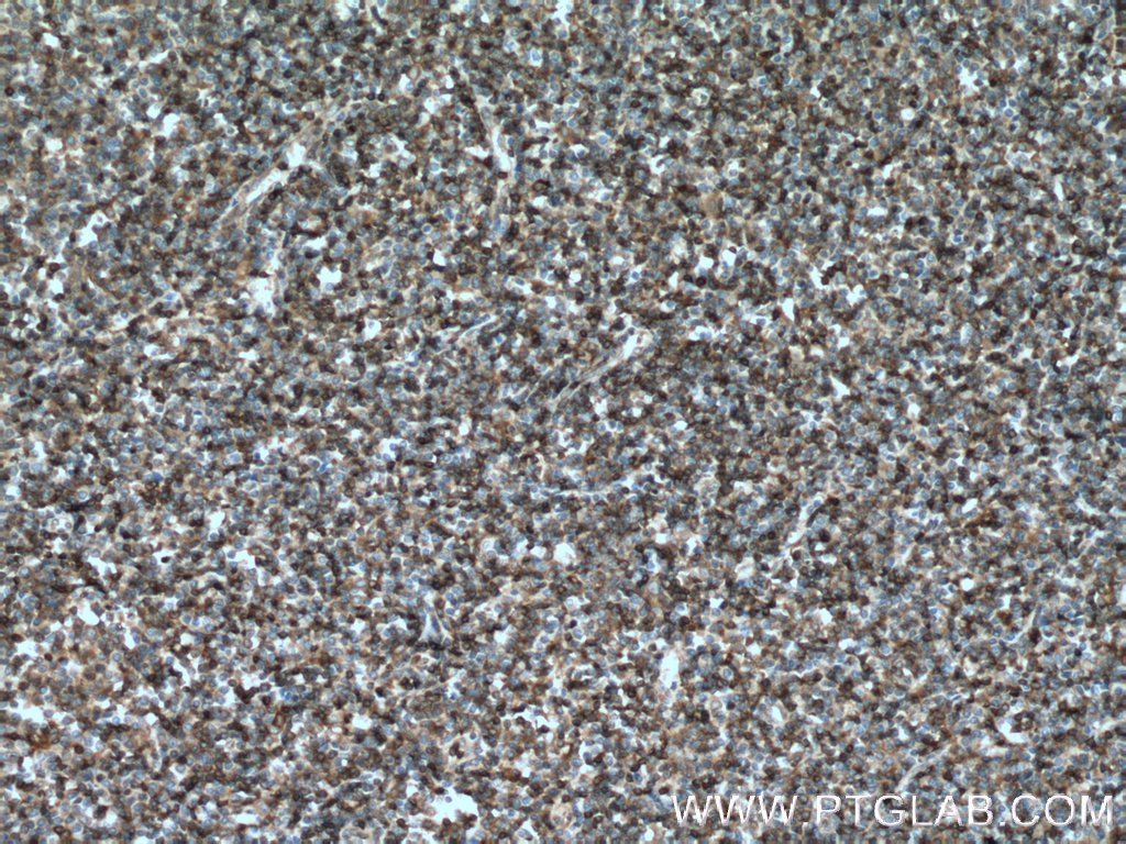 STK10 Polyclonal antibody