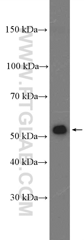 ACSF3 Polyclonal antibody
