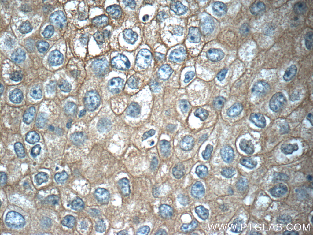 TMEM199 Polyclonal antibody