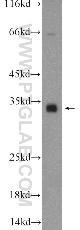 C18orf45 Polyclonal antibody