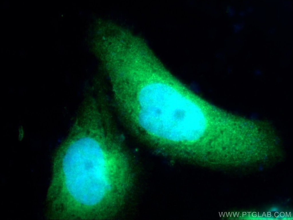 ZNF215 Polyclonal antibody