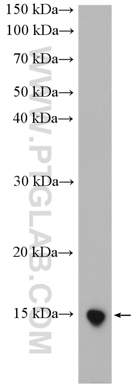 UCMA Polyclonal antibody
