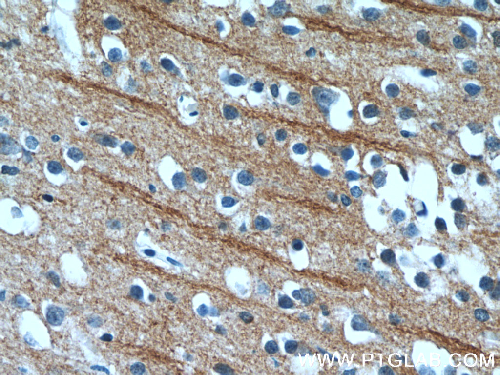 NPB Polyclonal antibody