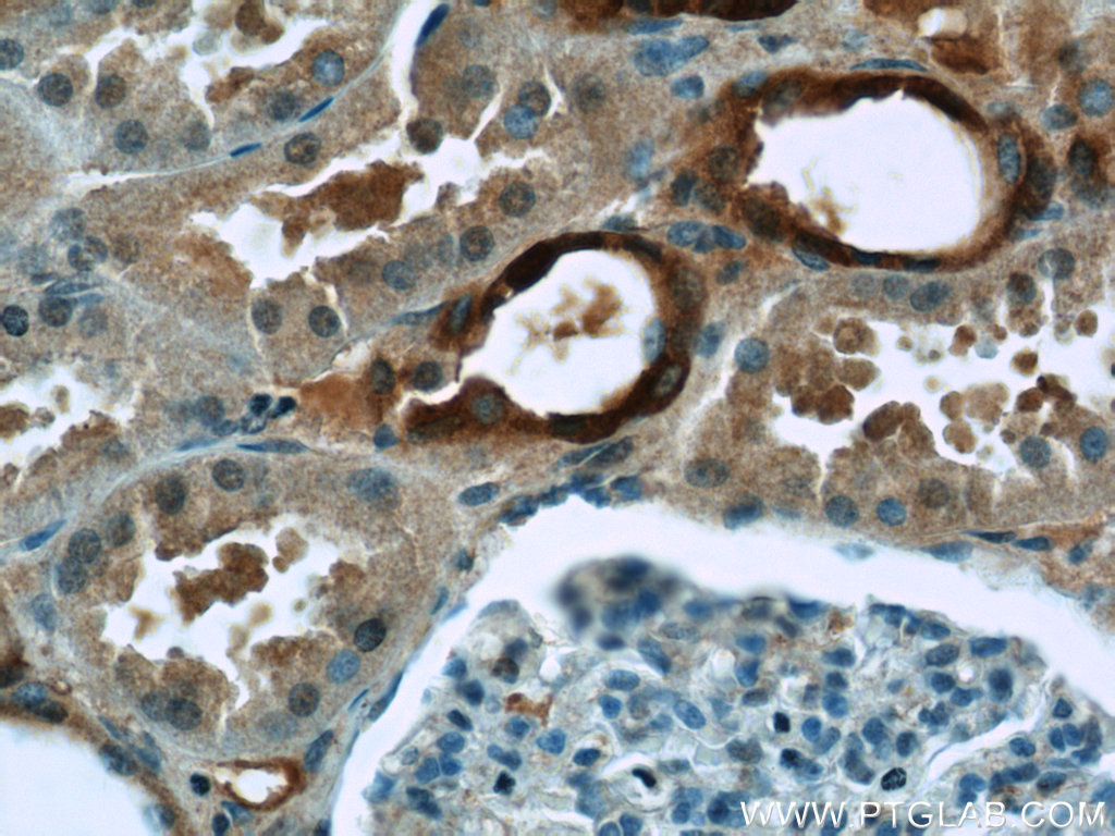 TAF15 Polyclonal antibody
