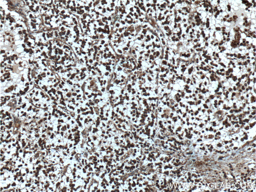 Beta Amyloid Polyclonal antibody
