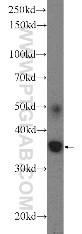 ATRAID Polyclonal antibody
