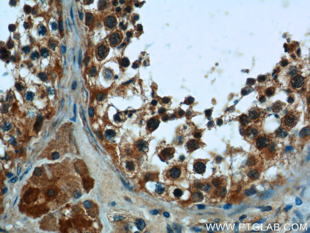 PNLDC1 Polyclonal antibody