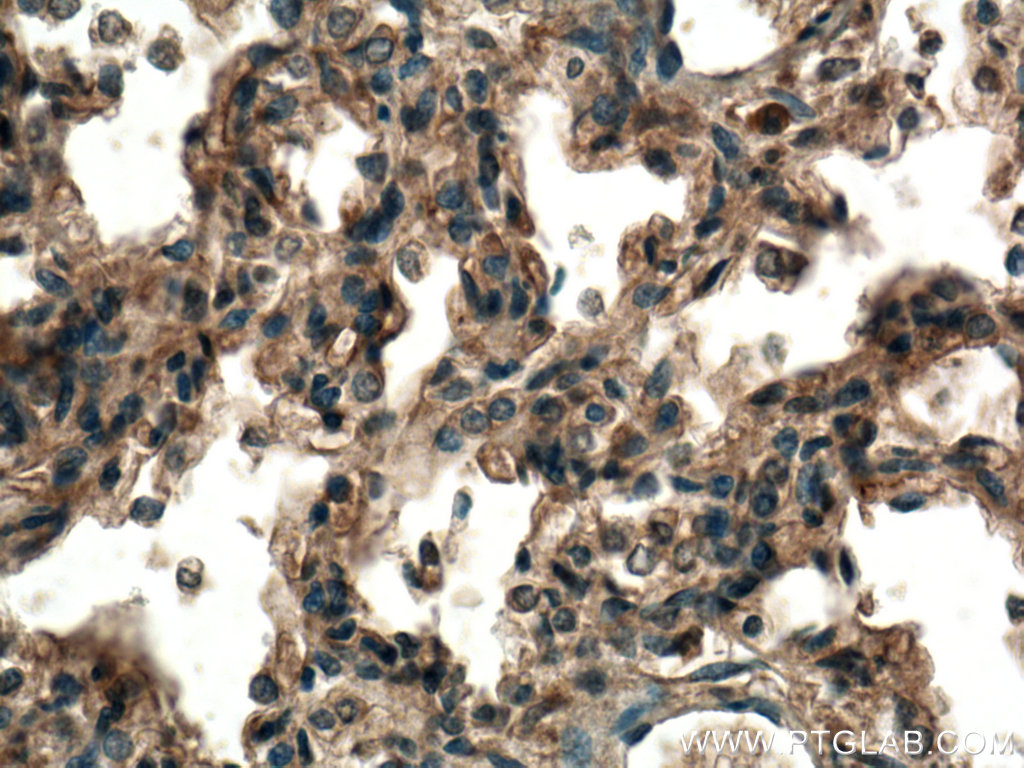 TMEM100 Polyclonal antibody