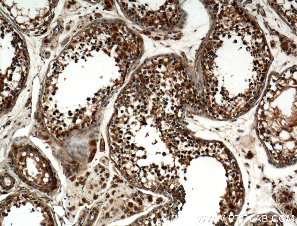 ZMYND12 Polyclonal antibody
