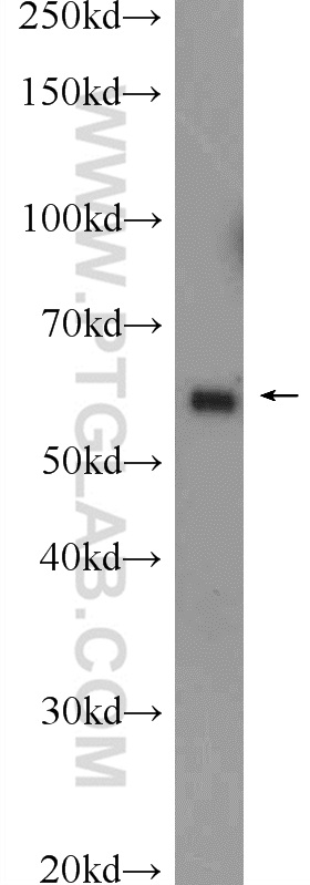 KLHL10 Polyclonal antibody