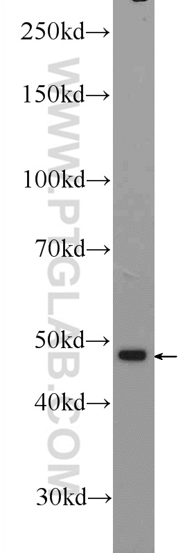 ZNF323 Polyclonal antibody