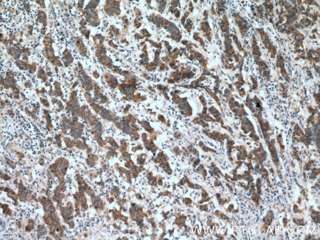 ZNF645 Polyclonal antibody