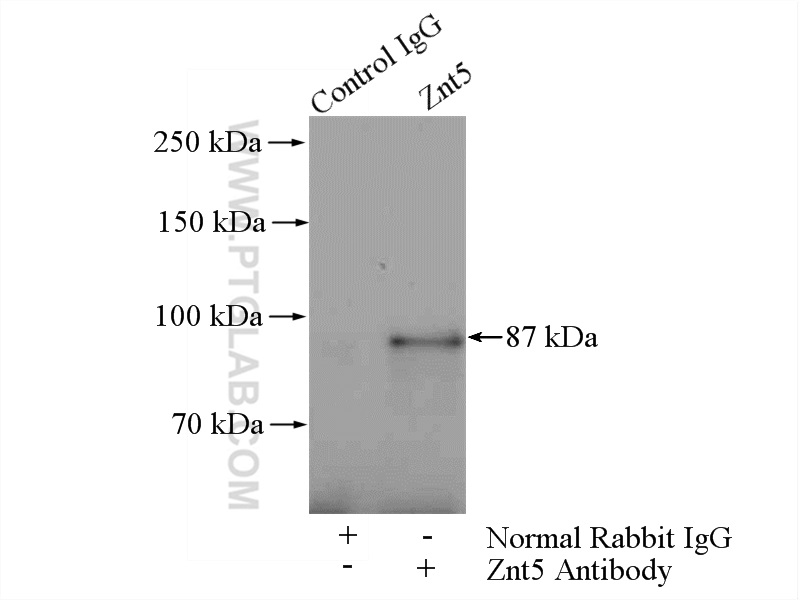 Znt5 Polyclonal antibody