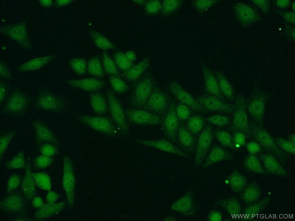SUPT7L Polyclonal antibody