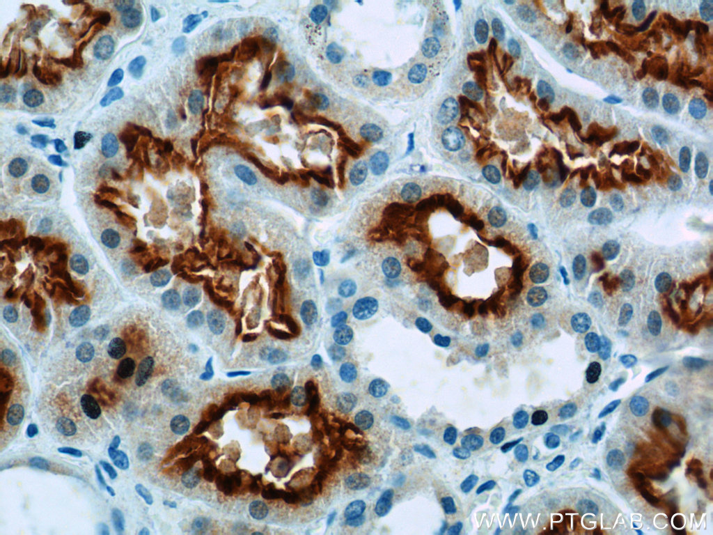 MUPCDH Polyclonal antibody