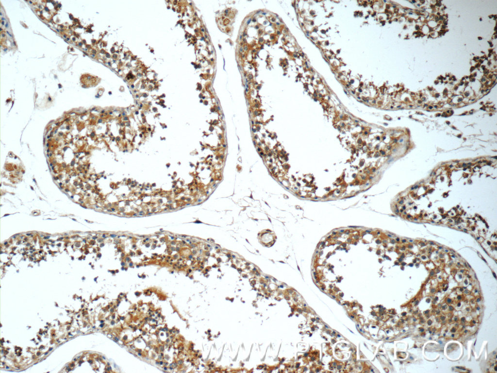 SLC52A3 Polyclonal antibody