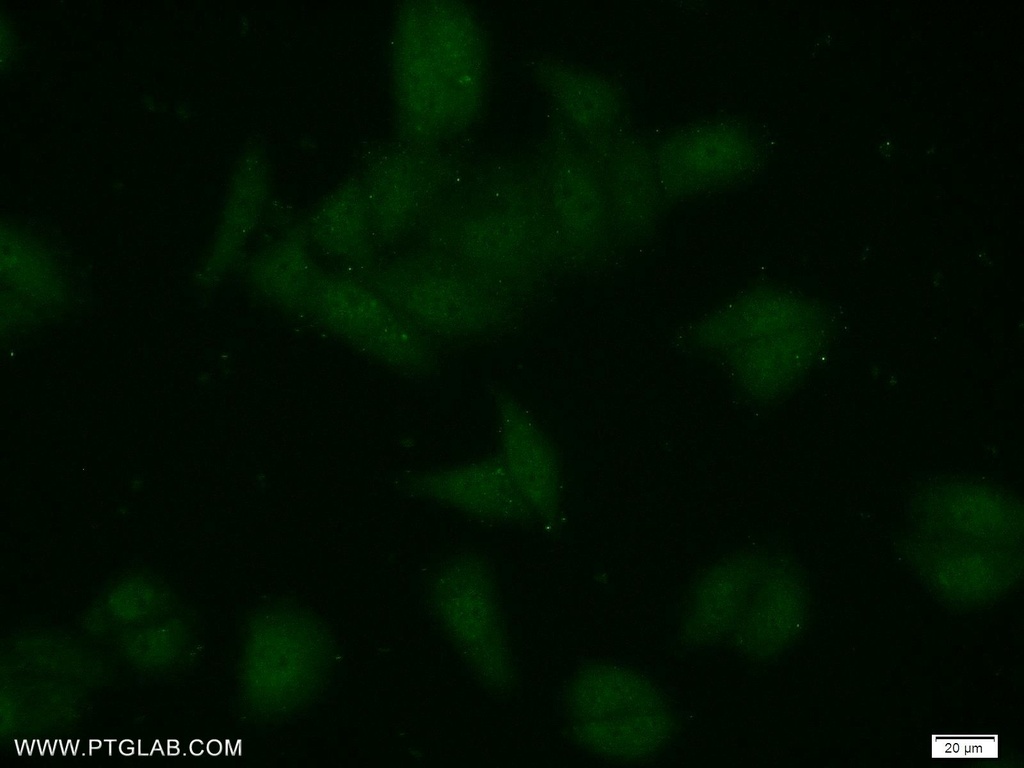 ZCRB1 Polyclonal antibody