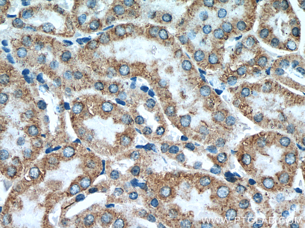 KIAA1279 Polyclonal antibody