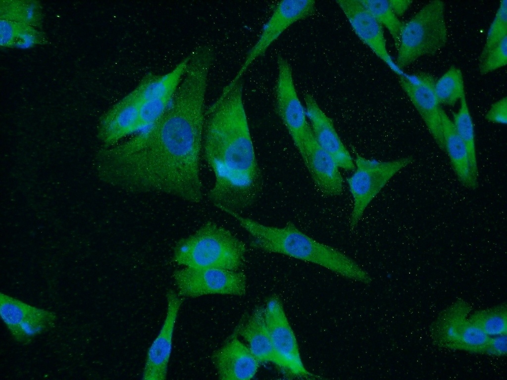 UACA Polyclonal antibody