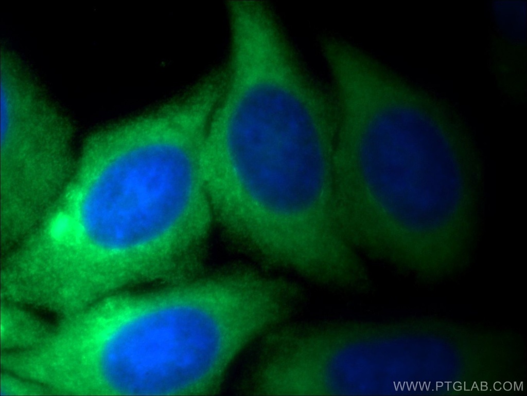 PKM Polyclonal antibody