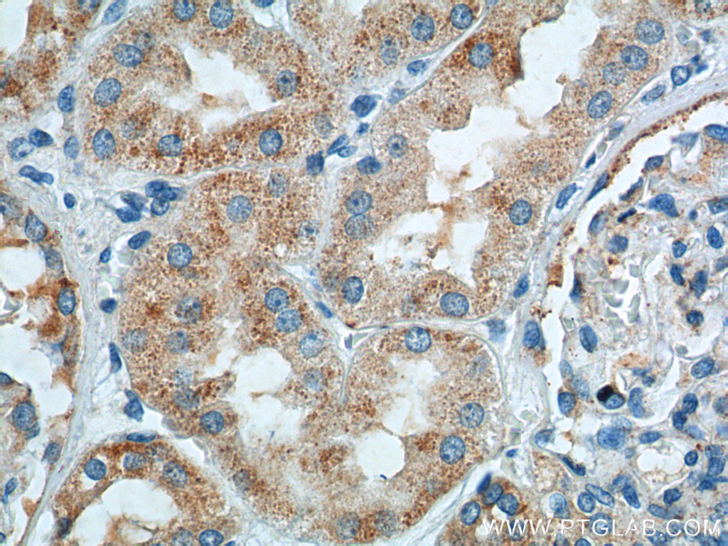 TTC17 Polyclonal antibody