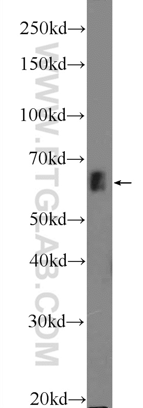 ZNF668 Polyclonal antibody